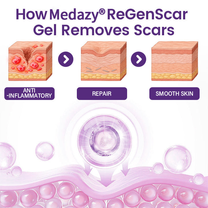 Medazy® ReGenScar Stem Cell Scar Gel