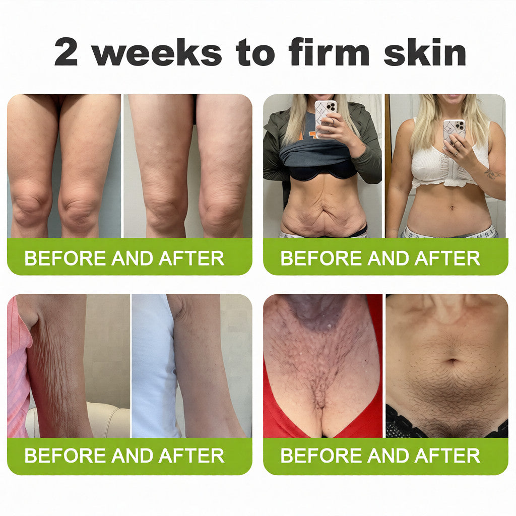 🧠👨‍⚕️Made and shipped from the USA 💫Lovilds® Botin & Vita-A Retinol Shot Wrinkle-Lift Tightening cream - Last Day Promotion 50% OFF