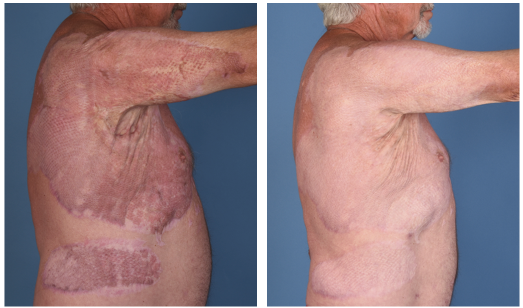 Medazy® HoneyShield Barrier Repair Cream